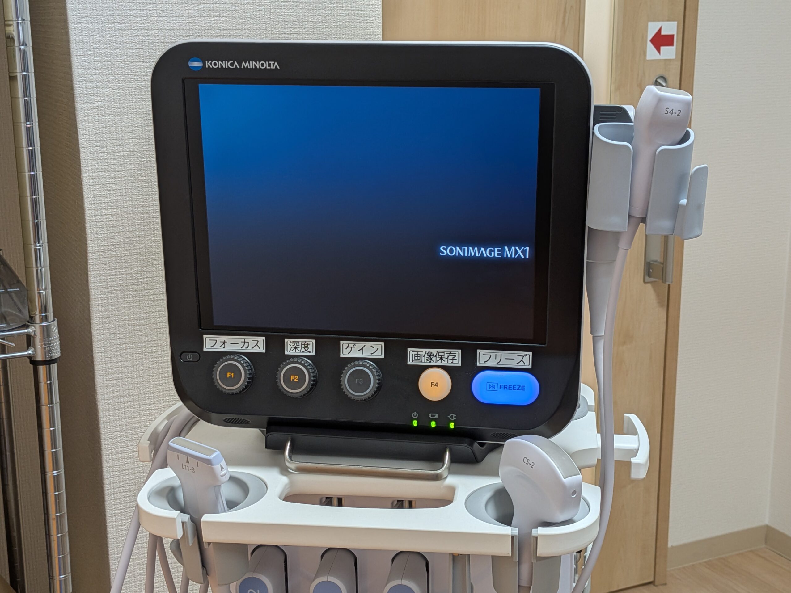 超音波診断装置（エコー）